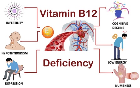 B12